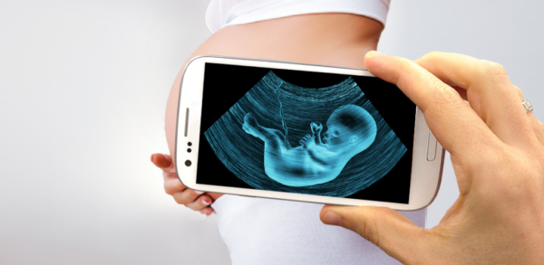 Aplicativos de Ultrassom para Gestantes: Guia